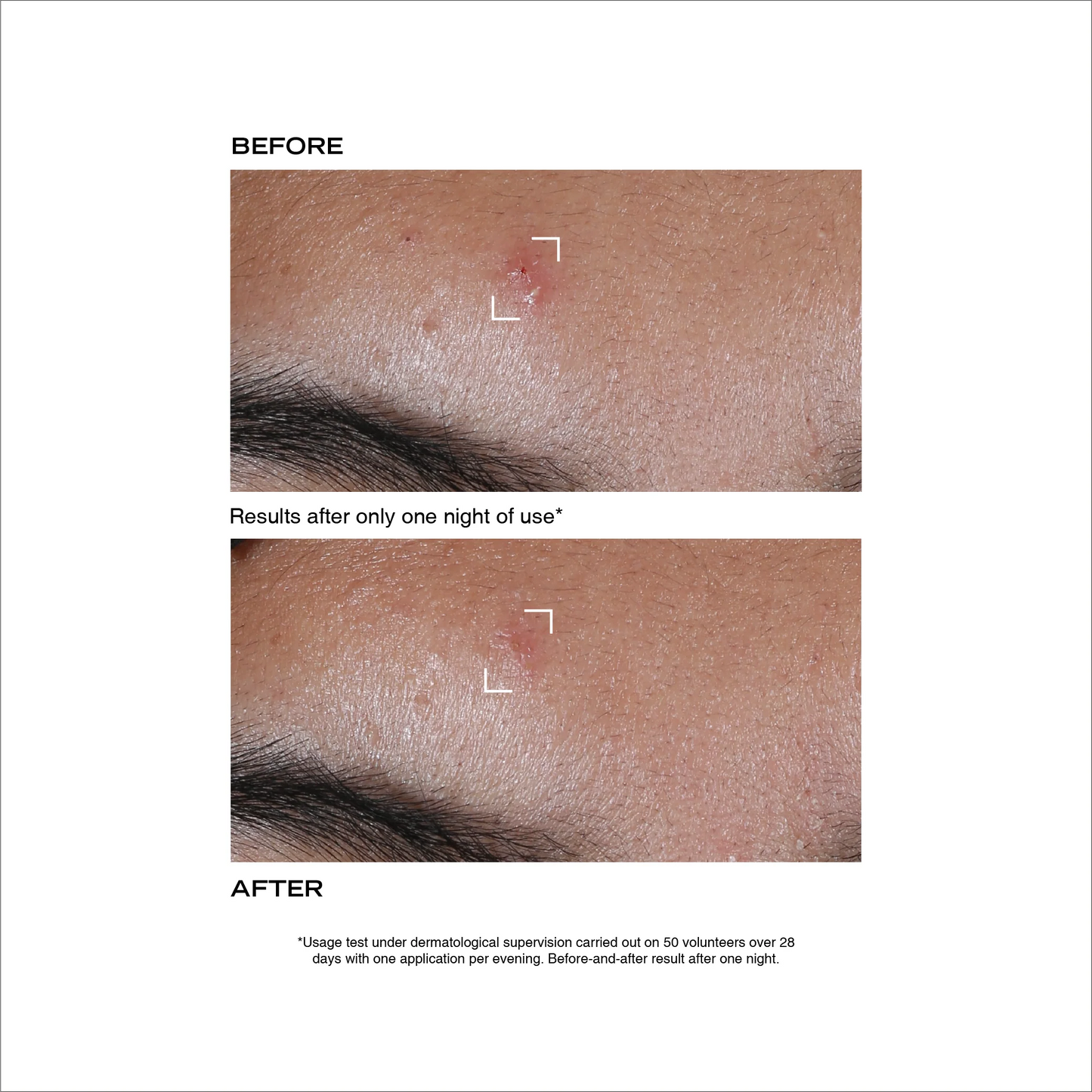 Pâte Originale Stop Bouton - Payot